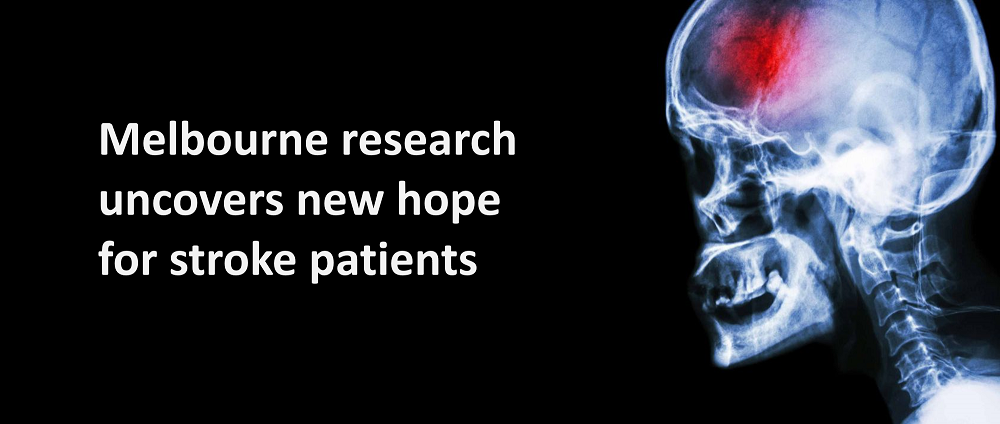 A significantly improved treatment for Stroke